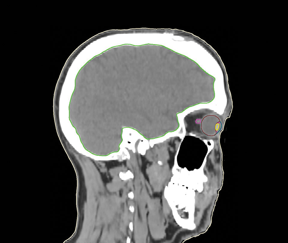 Brain CT Model