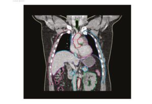 This image is a preview of MVision's Abdomen & Thorax auto-segmentation model, curated with quality and precision using classification.