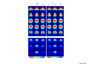 This image shows the predicted in-field dose distributions with 2 types of inputs. Image Credit: Chen, et. al via The International Journal of Medical Physics Research and Practice 