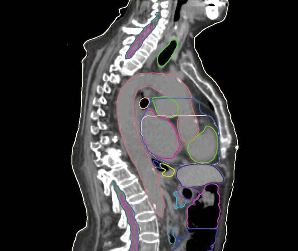 Abdomen & Thorax CT Model