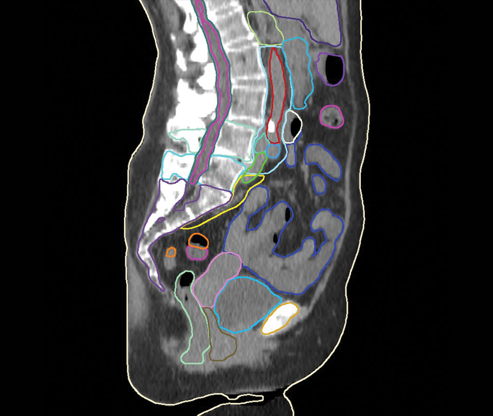 Female Pelvis CT Model
